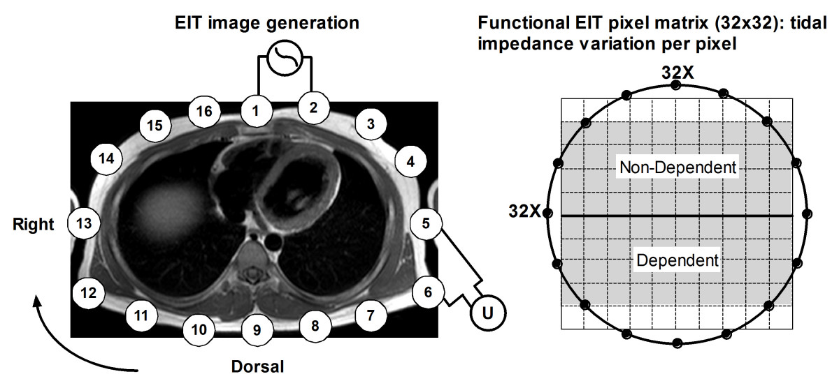 electrical impedance tomography eit a review