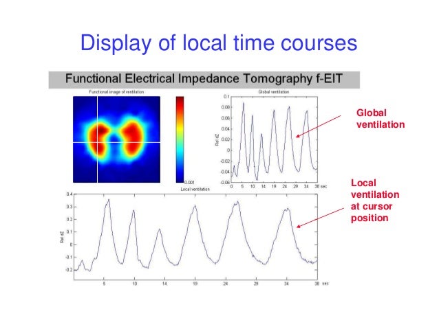 electrical impedance tomography eit a review
